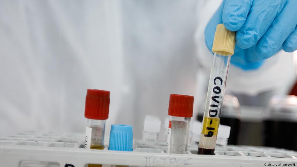 Rusia registra segundo medicamento para tratamiento de COVID-19