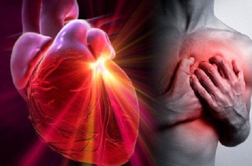 Una prueba de sangre podría ayudar a predecir los infartos hasta tres años antes